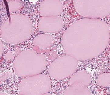 Magnified view of the Day 3 histology section: cells infiltrating the spaces between the collagen microspheres.