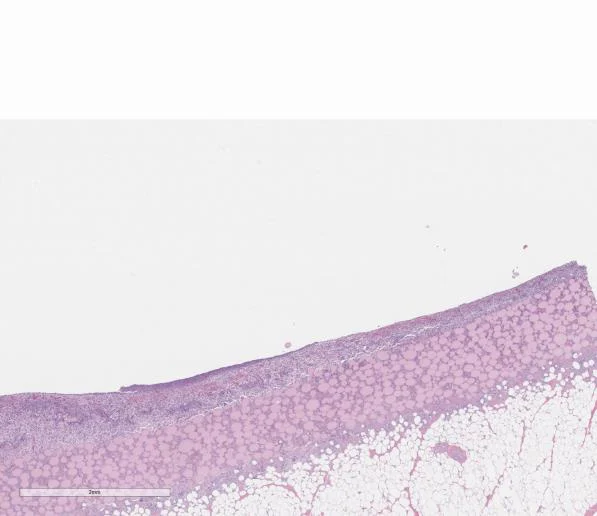 Histology section of DermiSphere hDRT in a full-thickness wound at Day 7