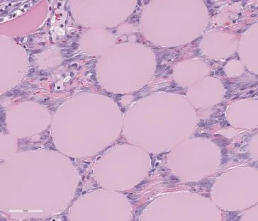 Magnified view of the Day 7 histology section: new blood vessels forming between the collagen microspheres.