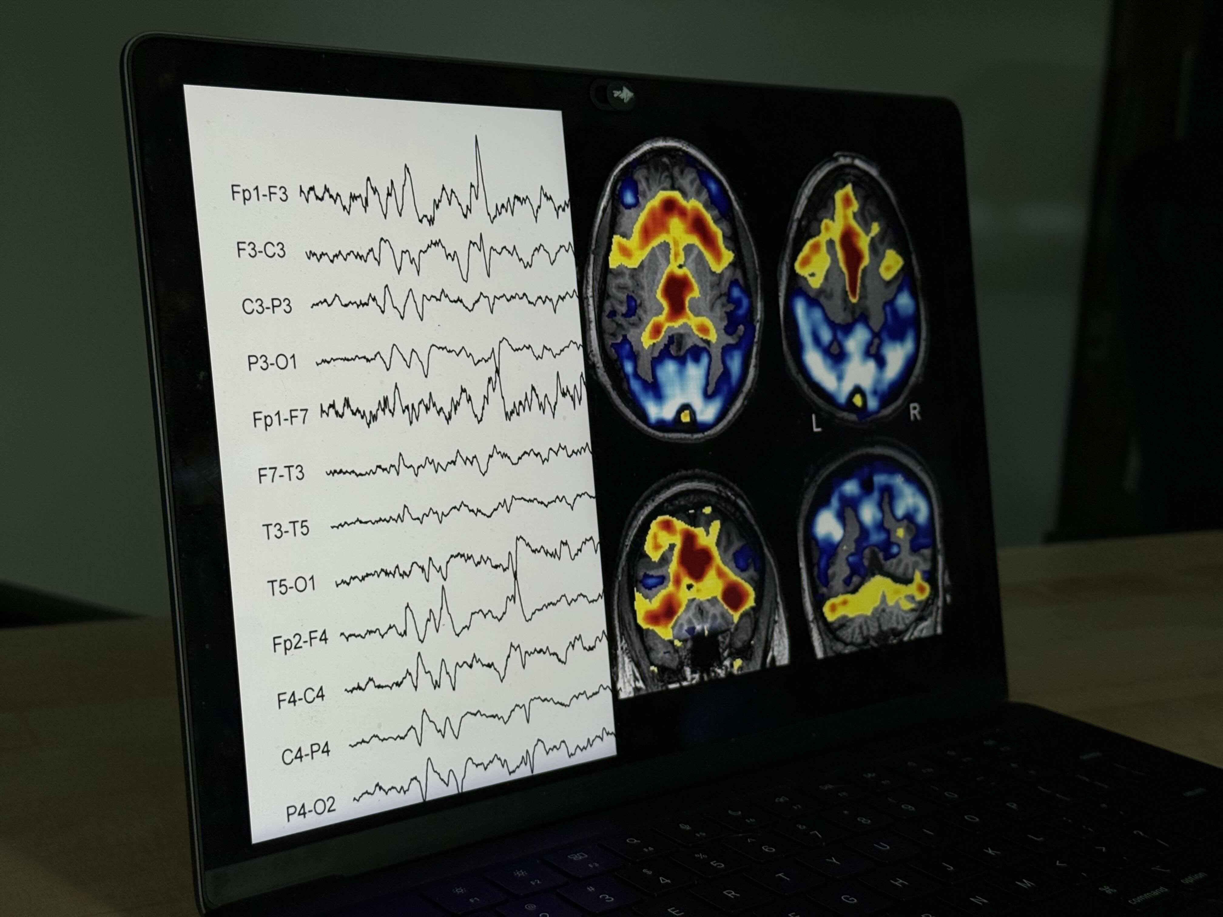 An RV in front of mountains