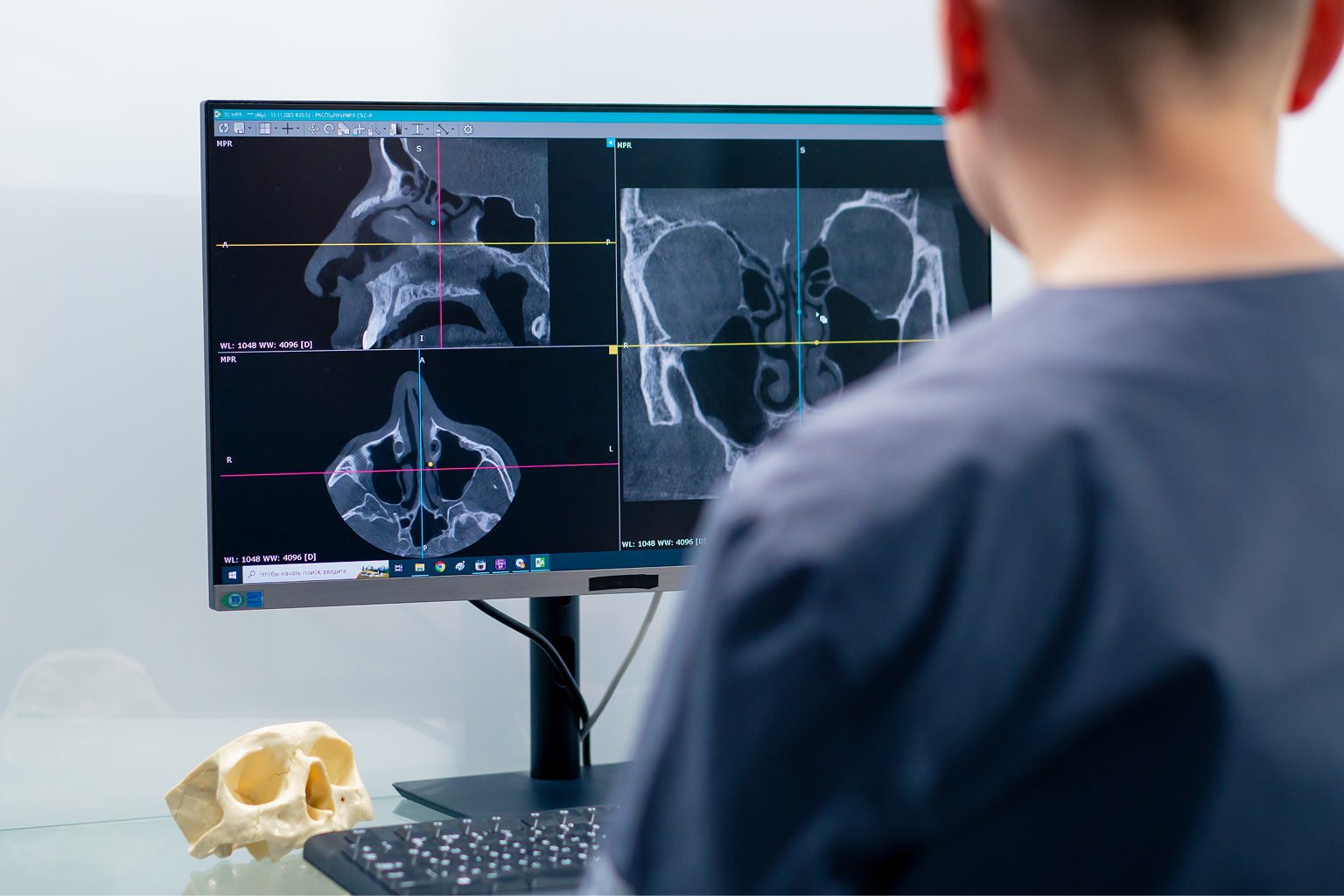 Reading Thresholds and Minor Misdiagnoses