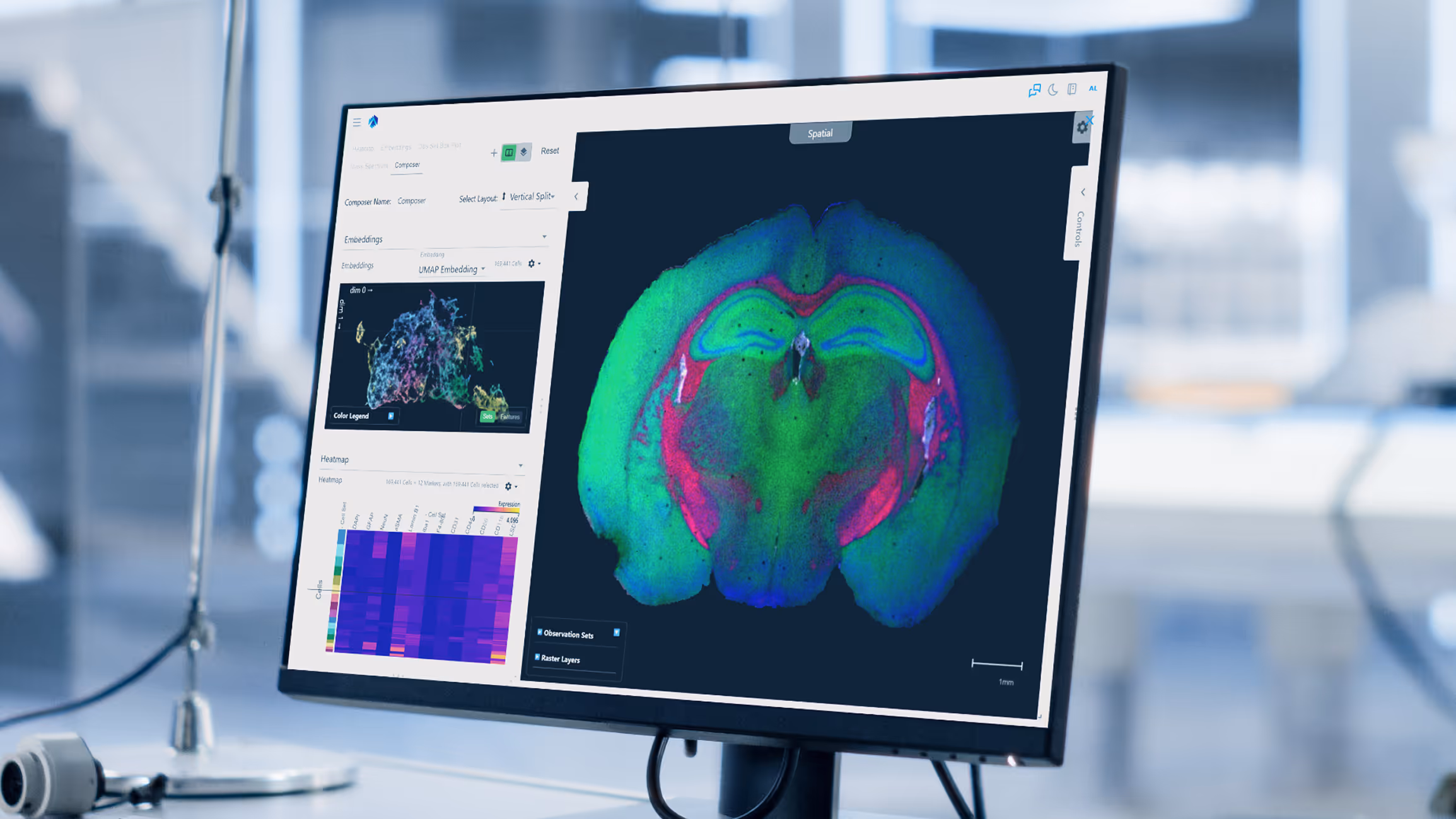 Colorful brain scan visualization on medical computer screen