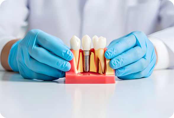 Durable Dental Implants inserted into the jawbone