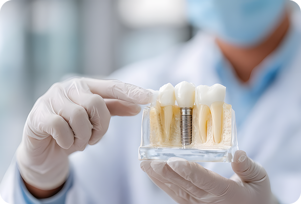 Durable Dental Implants inserted into the jawbone