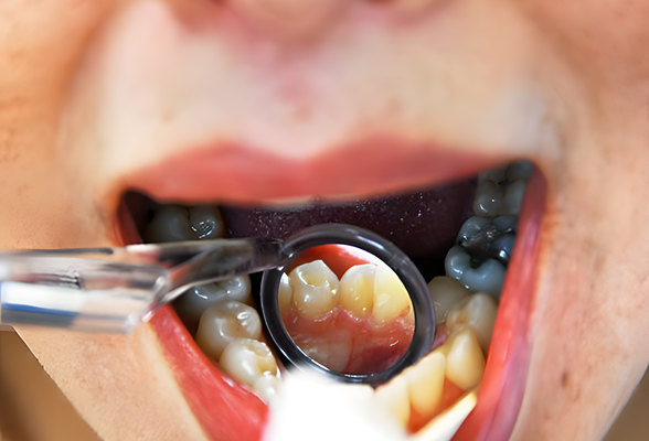 Comprehensive Dental Exams for total oral health