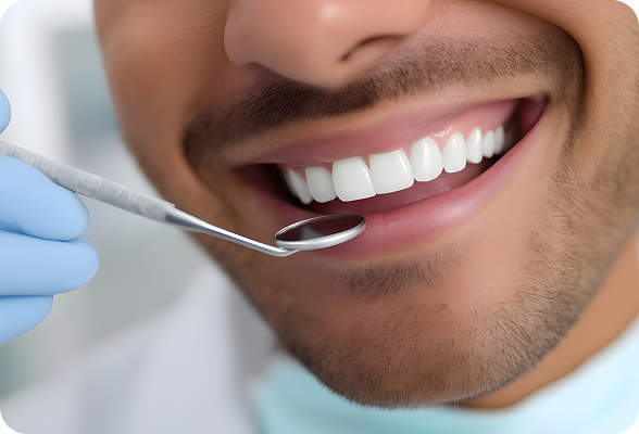 Brighten your smile with Teeth Whitening