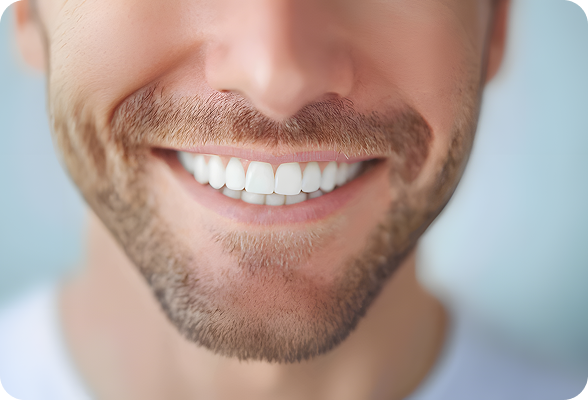 Natural and stunning porcelain veneers