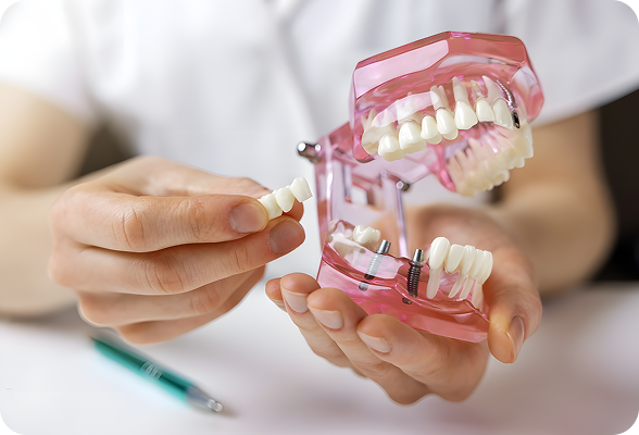 Custom-made Dental Crowns