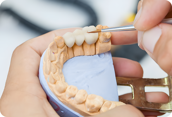 Custom-made Dental Crowns