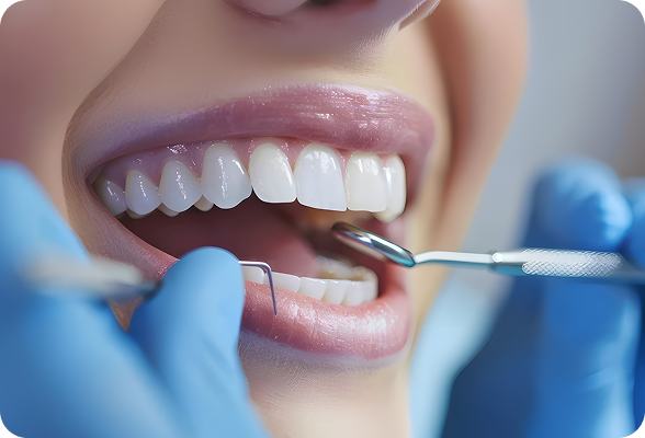 Natural and stunning porcelain veneers