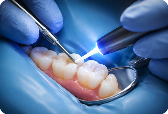 a routine preventative procedure (prophylaxis) involving a physical exam, plaque/tartar removal (scaling), polishing, and flossing to maintain oral health, prevent gum disease, and remove surface stains