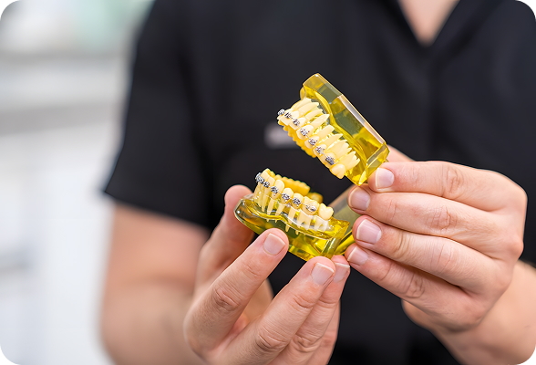 Custom-made Dental Crowns