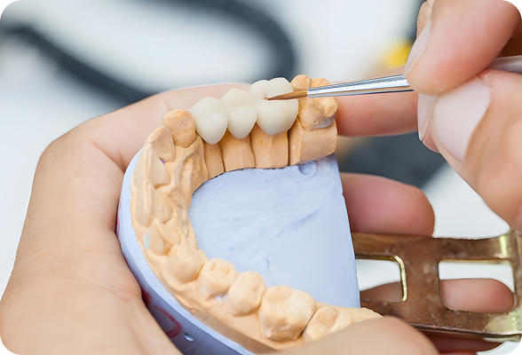 Custom-made Dental Crowns