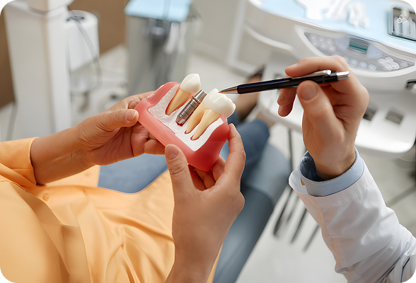 Durable Dental Implants inserted into the jawbone