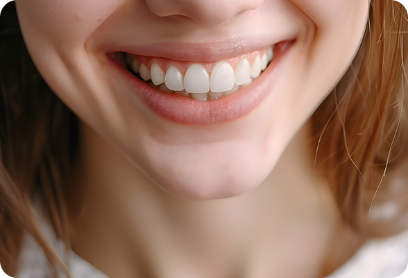 Natural and stunning porcelain veneers