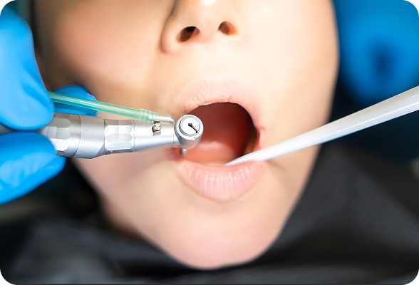 General and family dentistry provides comprehensive oral healthcare for patients of all ages, focusing on the diagnosis, treatment, and prevention of dental diseases.