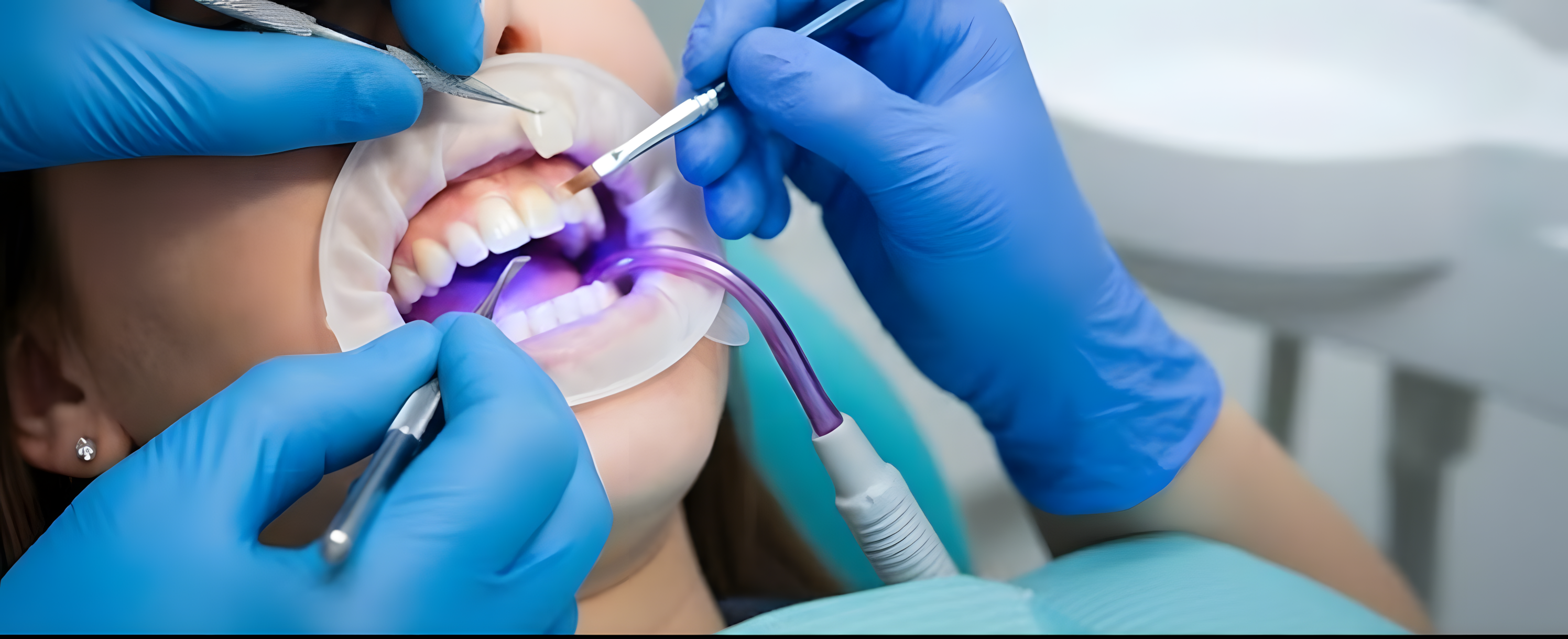 Tooth extraction is the removal of a tooth from its socket in the jawbone, performed by a dentist or oral surgeon using local anesthesia to alleviate pain from decay, infection, or overcrowding.