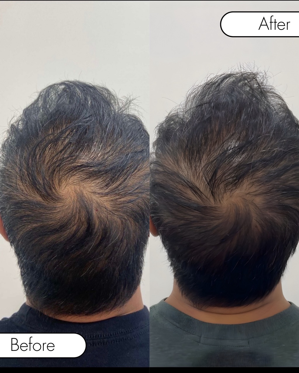 Results for before and After