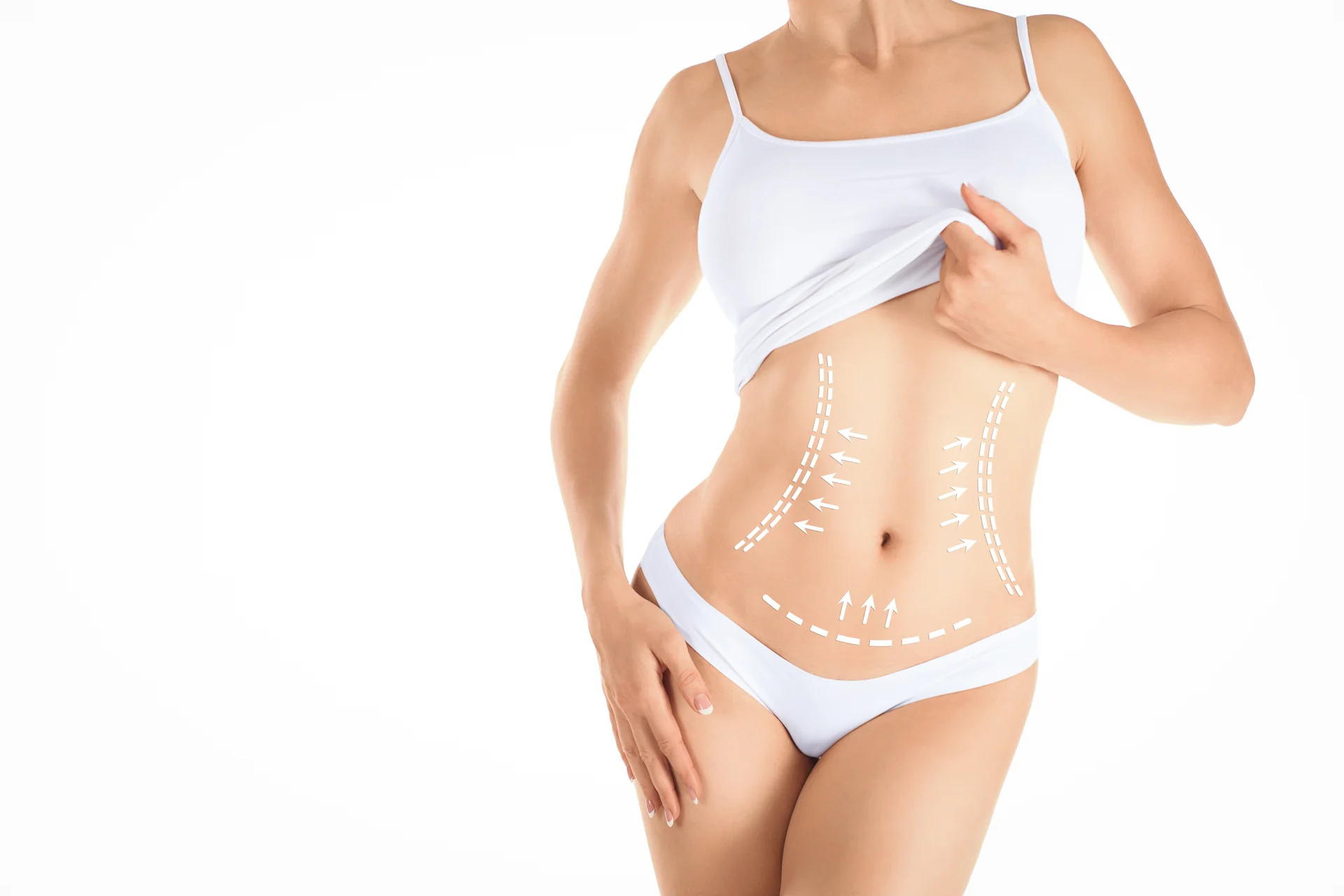 Mommy Makeover kapsamında karın germe ve vücut şekillendirme planlaması