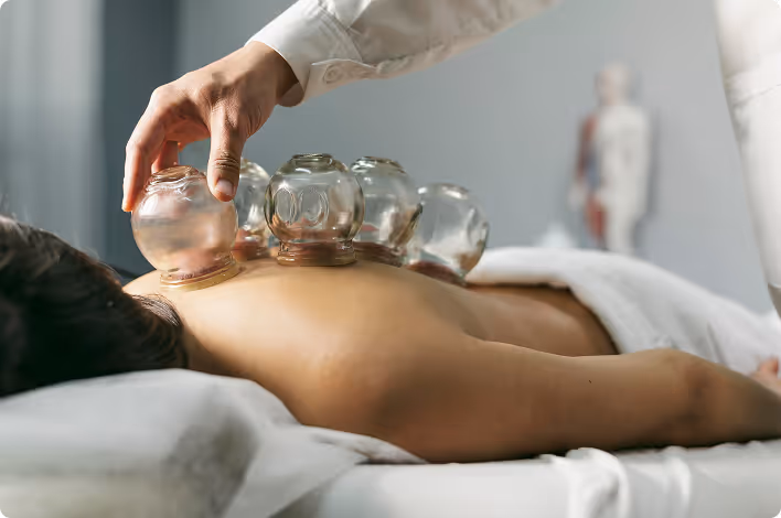 A person is lying face down on a massage table, receiving cupping therapy. Several glass cups are placed on their back, and a hand adjusts one. The setting is calm and professional.