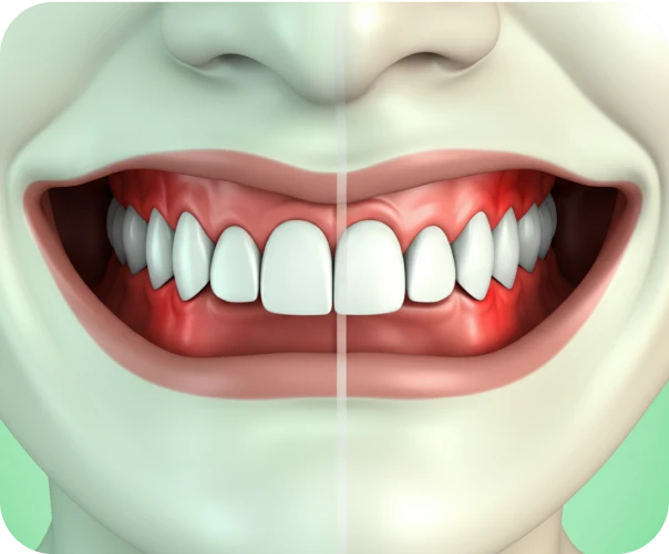 AirOral - Webflow Template Image