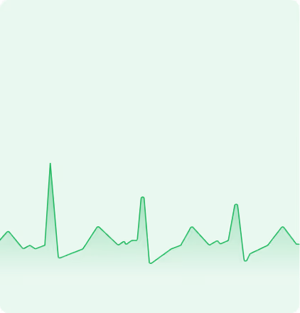 Green graph with a trend of sharp upward spikes and gradual downward slopes against a lighter green background.