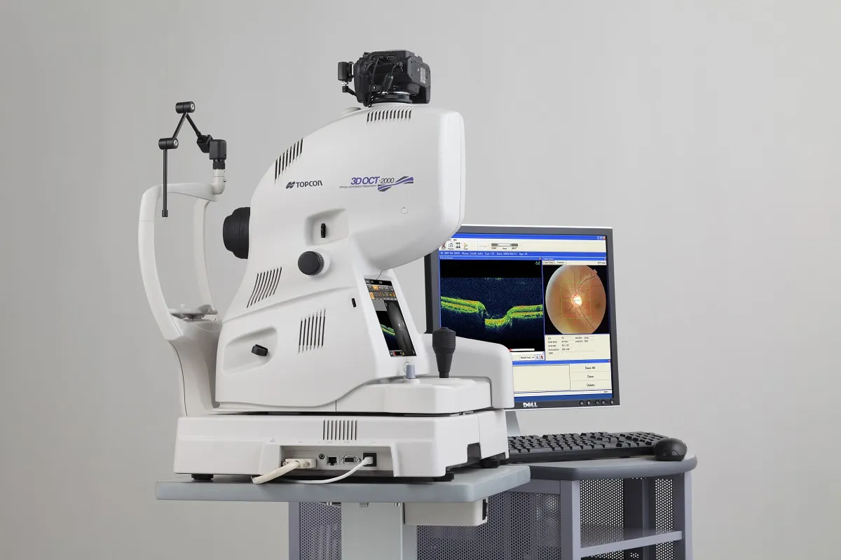Topcon 3D OCT 2000 optical coherence tomography machine next to a computer displaying a retinal scan and eye imaging software.