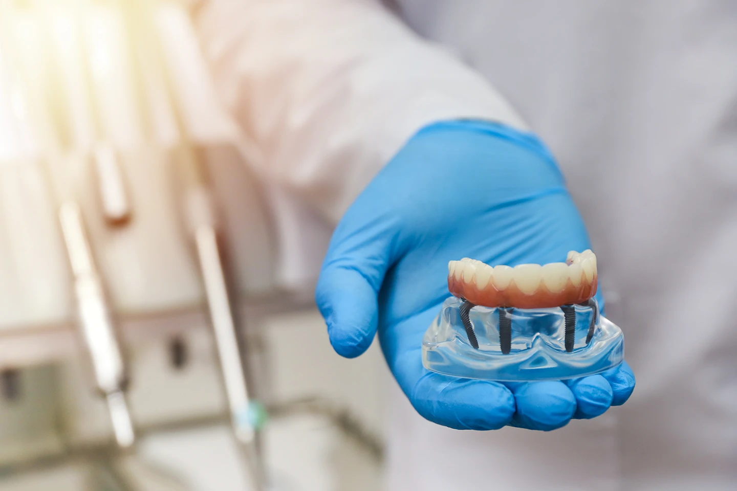 Close-up of a gloved hand holding a dental implant model with artificial teeth mounted on metal posts.