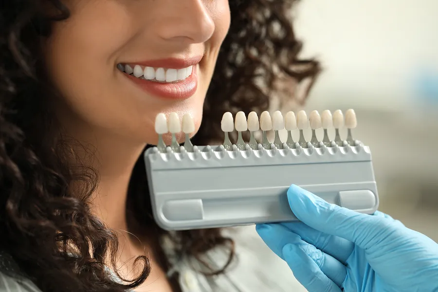 Close-up of a smiling woman with white teeth matching dental veneers shades held by a gloved hand.