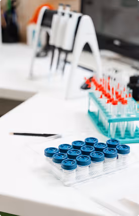 Tray of small laboratory sample tubes with blue caps on a white lab bench.