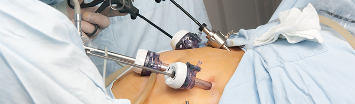 Laparoscopia: Útero, Ovário e Ginecológica