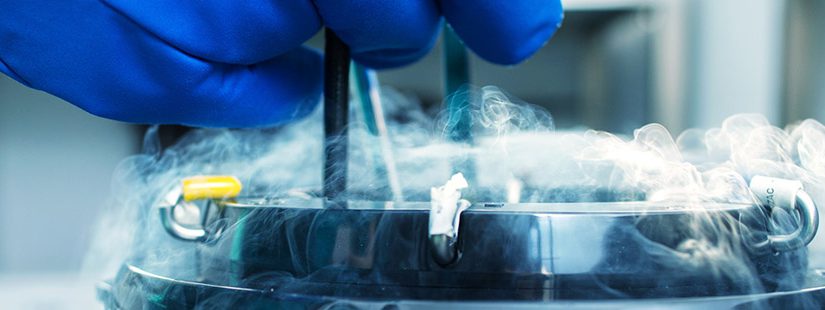 O que você precisa saber sobre Quantidade de Óvulos