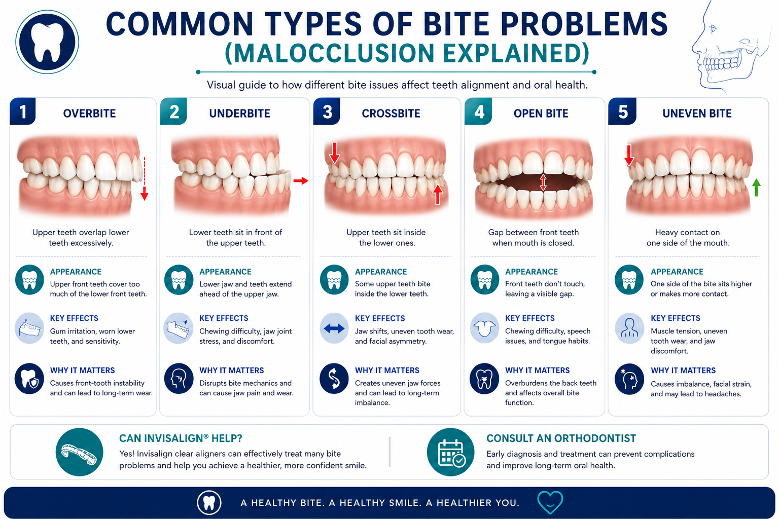 info graphic on common types of bite problems including overbite, underbite, crossbite, openbite & uneven bite