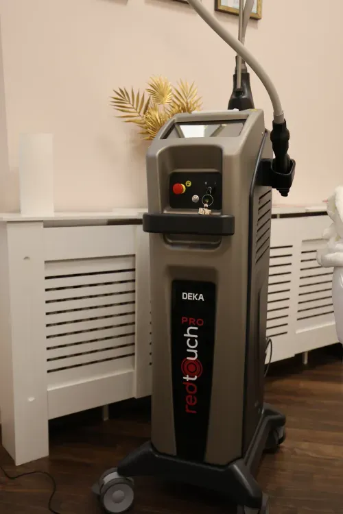 DEKA Touch Pro Laser Hautverjüngung und Kollagenaufbau im Beautyroom Berlin