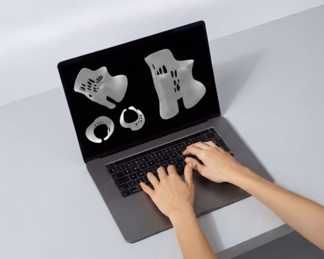 Hands typing on a laptop keyboard with 3D anatomical spine model parts displayed on the screen.