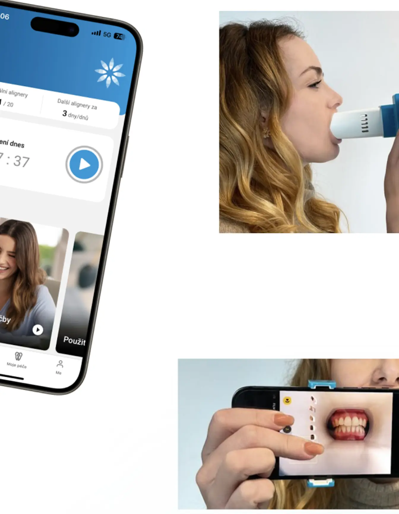 Žena používá zařízení a mobilní aplikaci k sledování zubního stavu, včetně držení přístroje v ústech a zobrazení snímku zubů na telefonu.