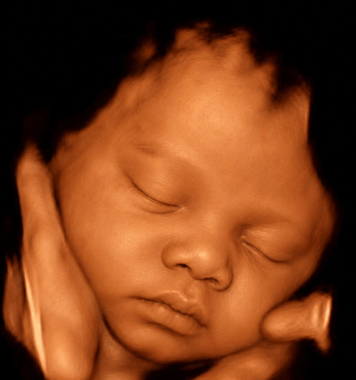 3D ultrasound baby image
