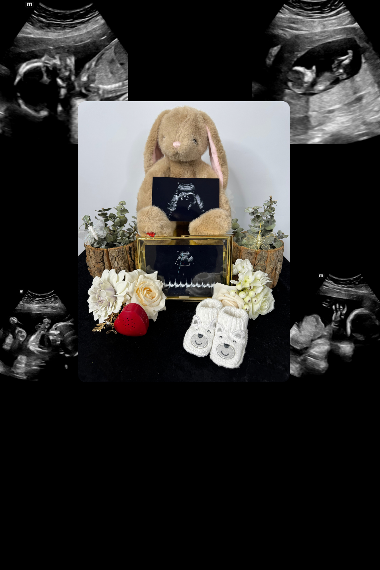 image of an ultrasound machine in a consulting room of a medical clinic