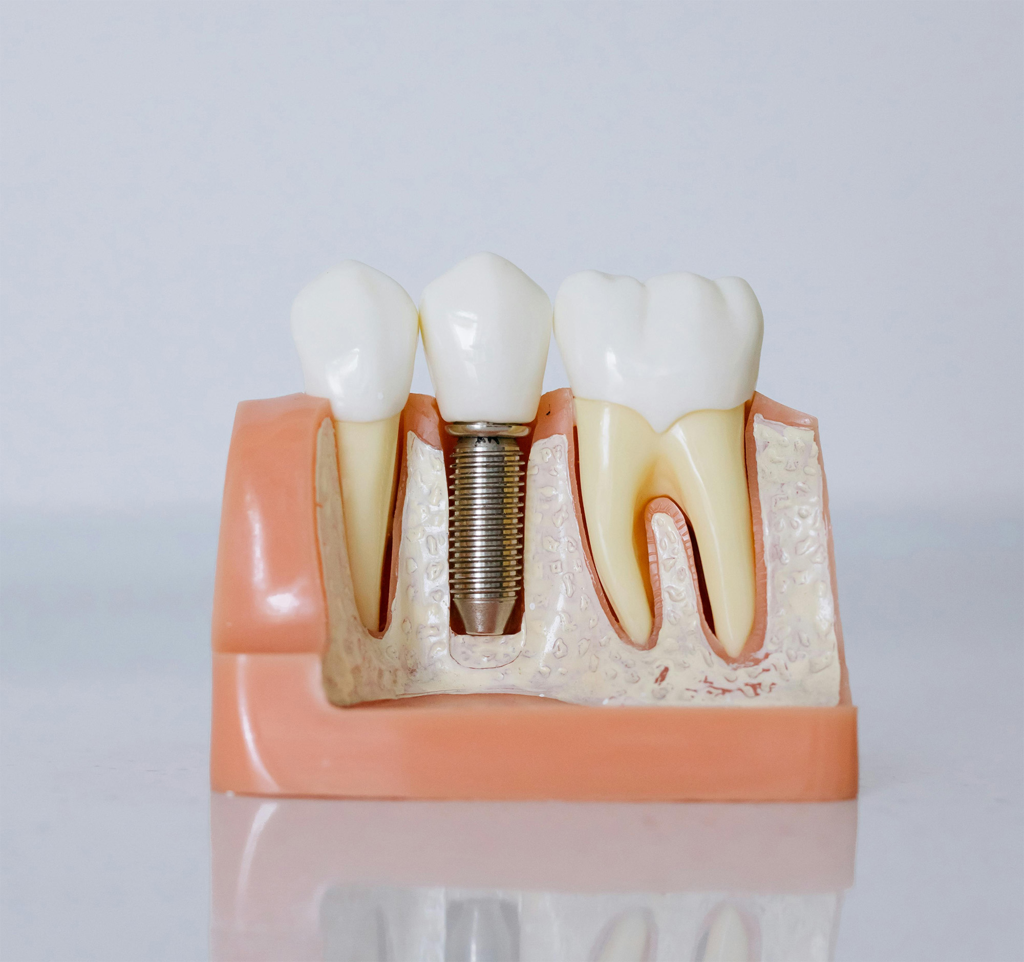 Smiling woman with wavy blonde hair holding a hand mirror, examining her teeth.
