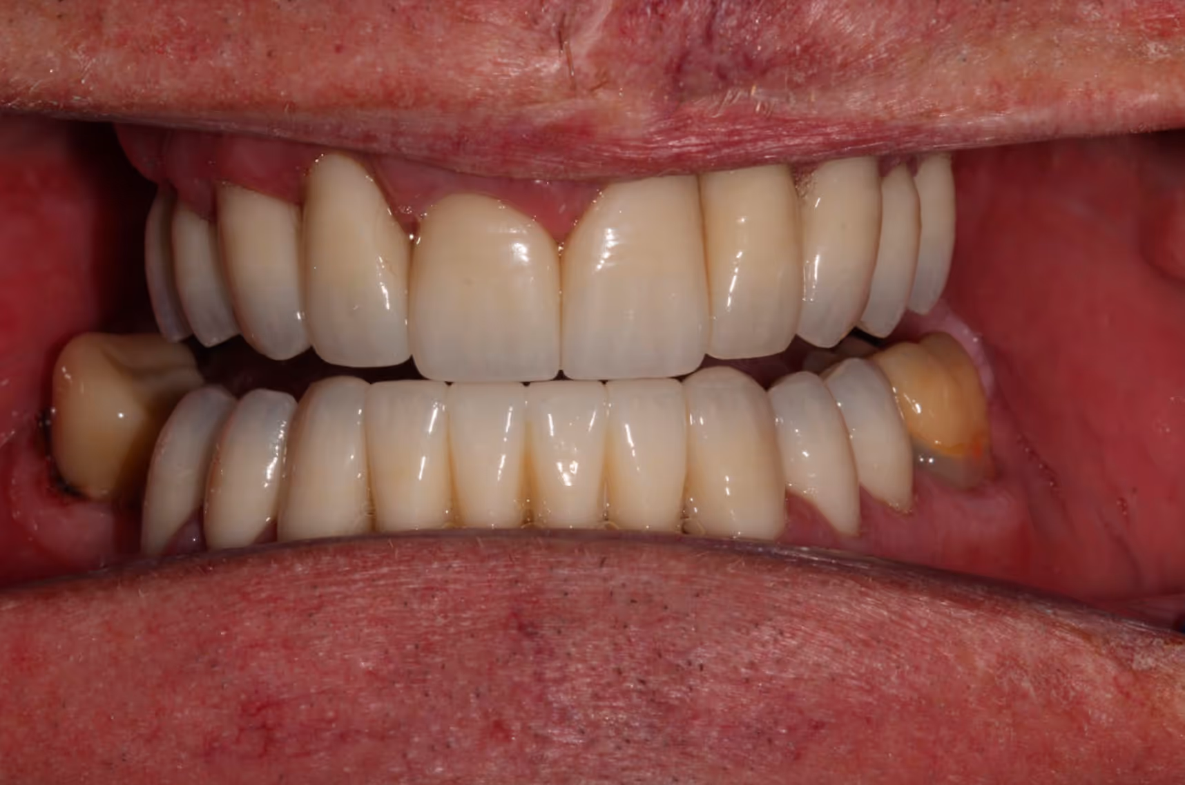 Smiling woman with wavy blonde hair holding a hand mirror, examining her teeth.