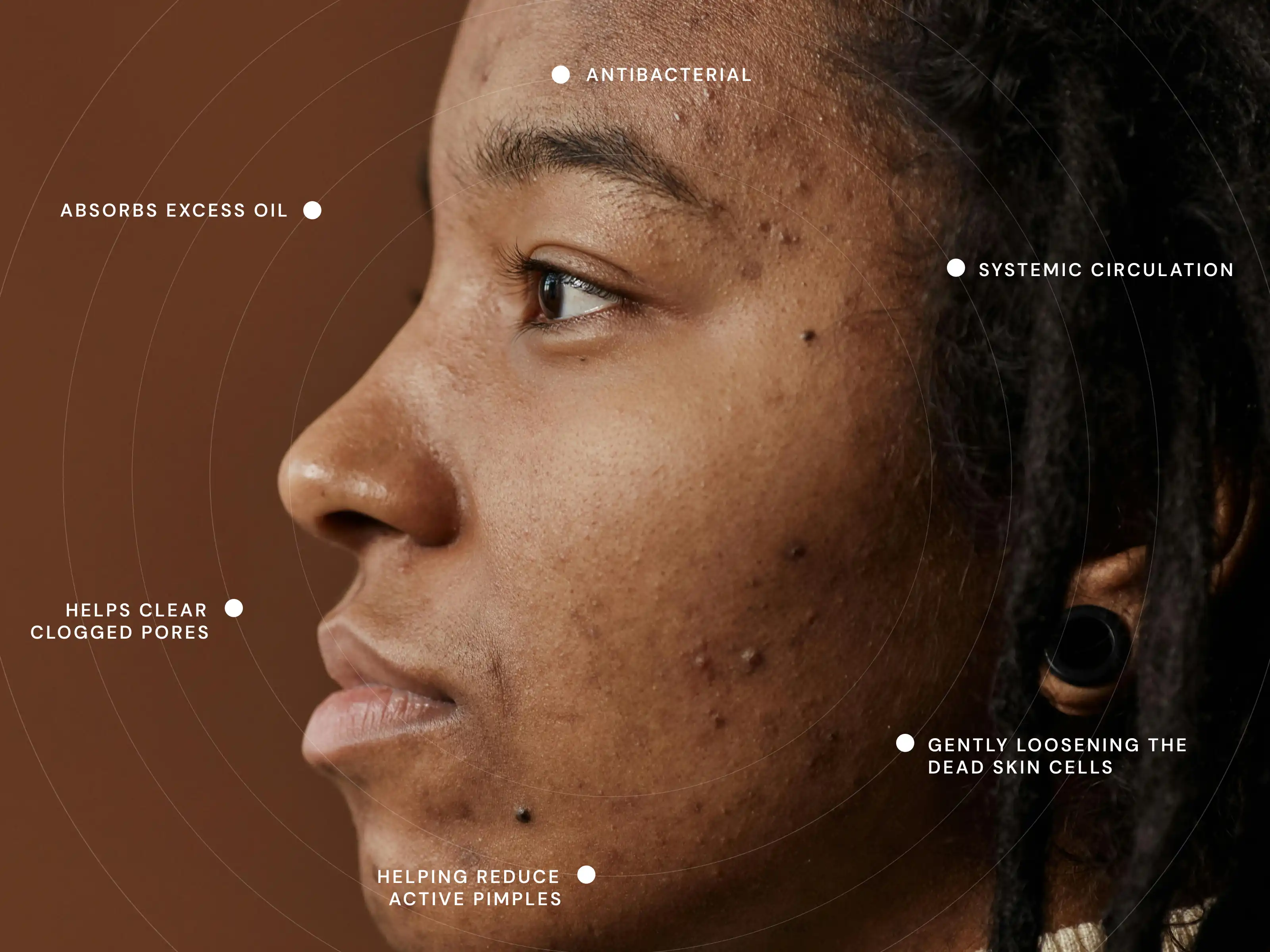 How does Acne Formula: Wash work?