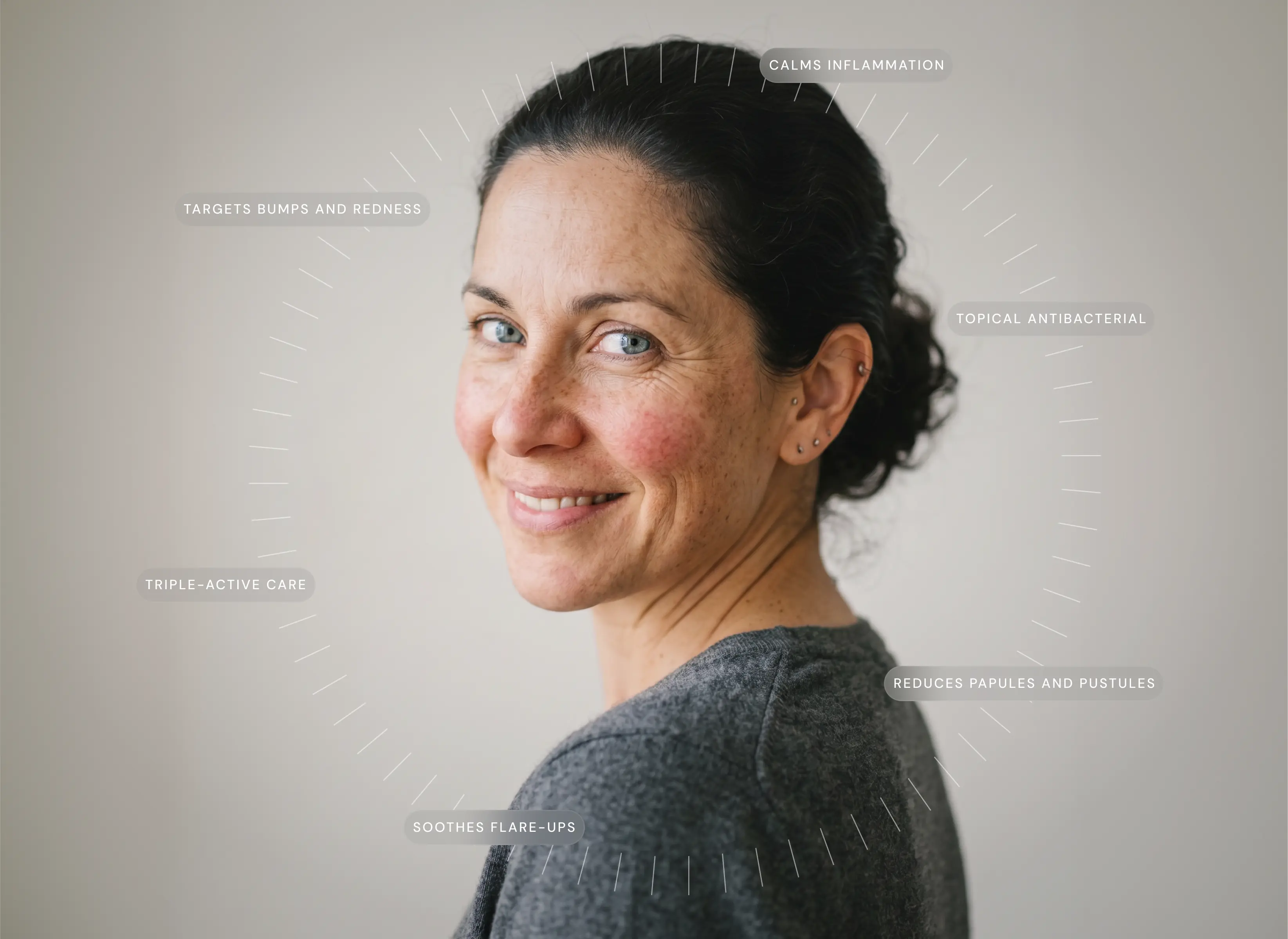 How does Rosacea Formula: Inflammation work?