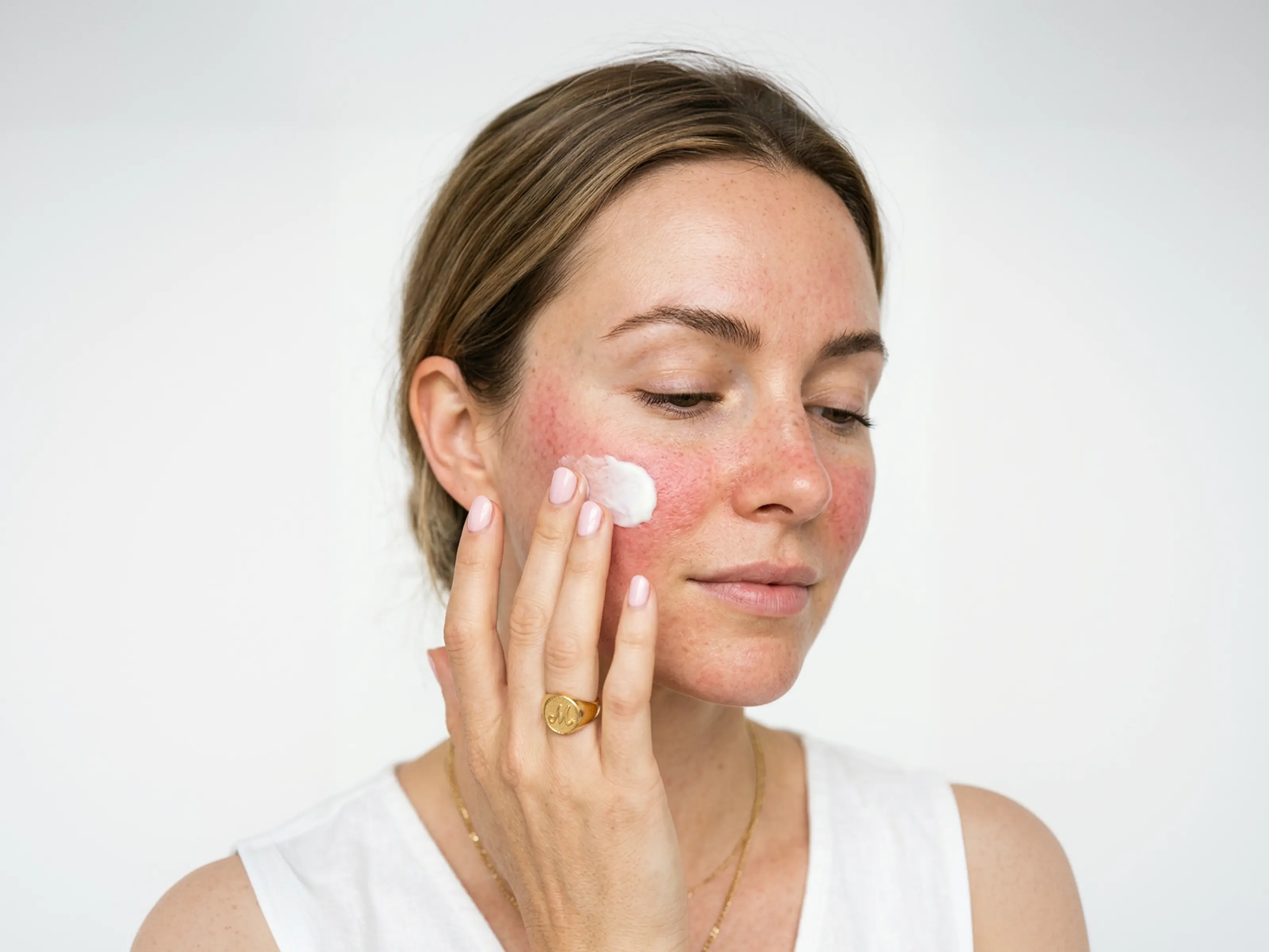 How to use Rosacea Formula: Inflammation?