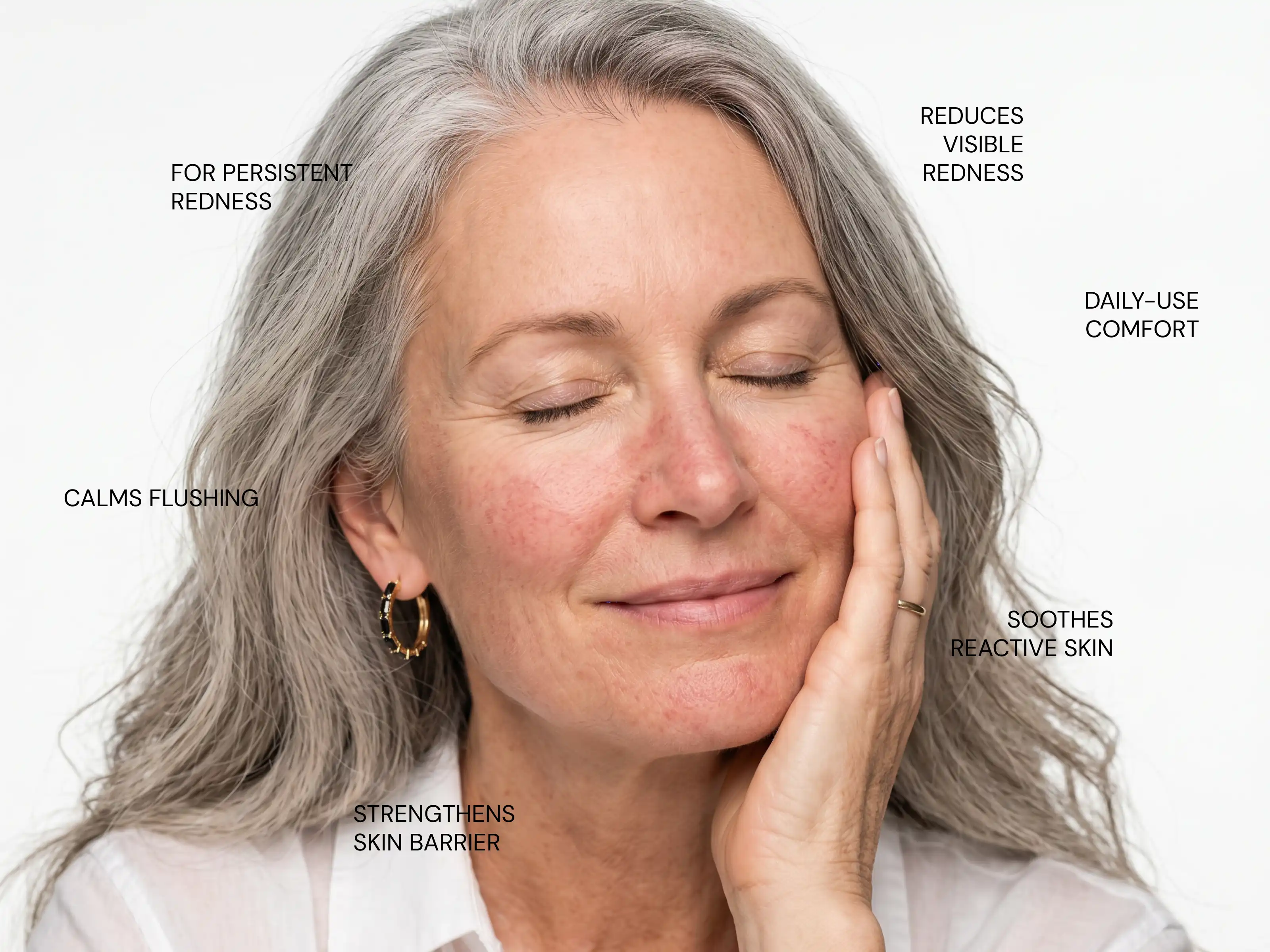 How does Rosacea Formula: Redness Relief work?
