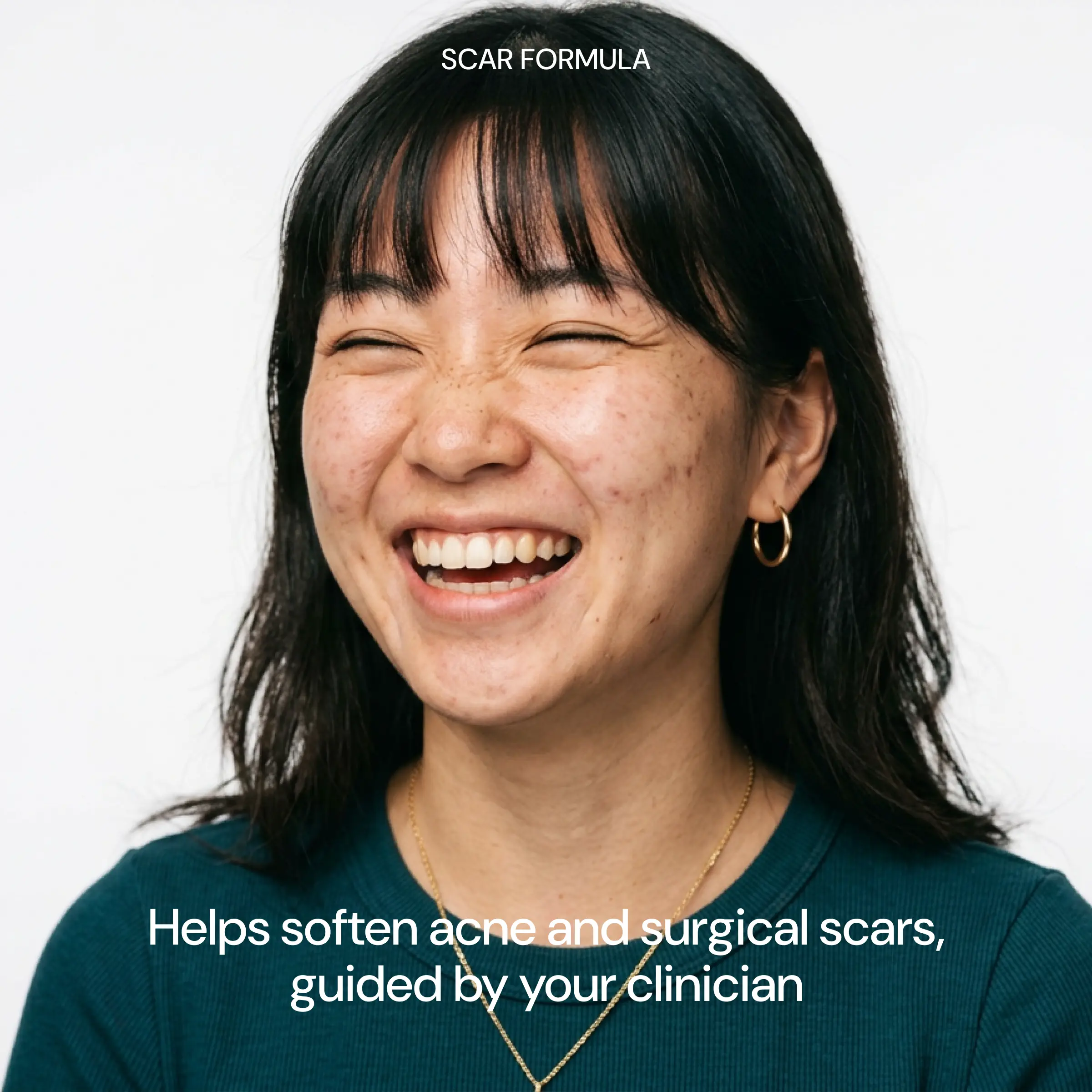 Scar Formula