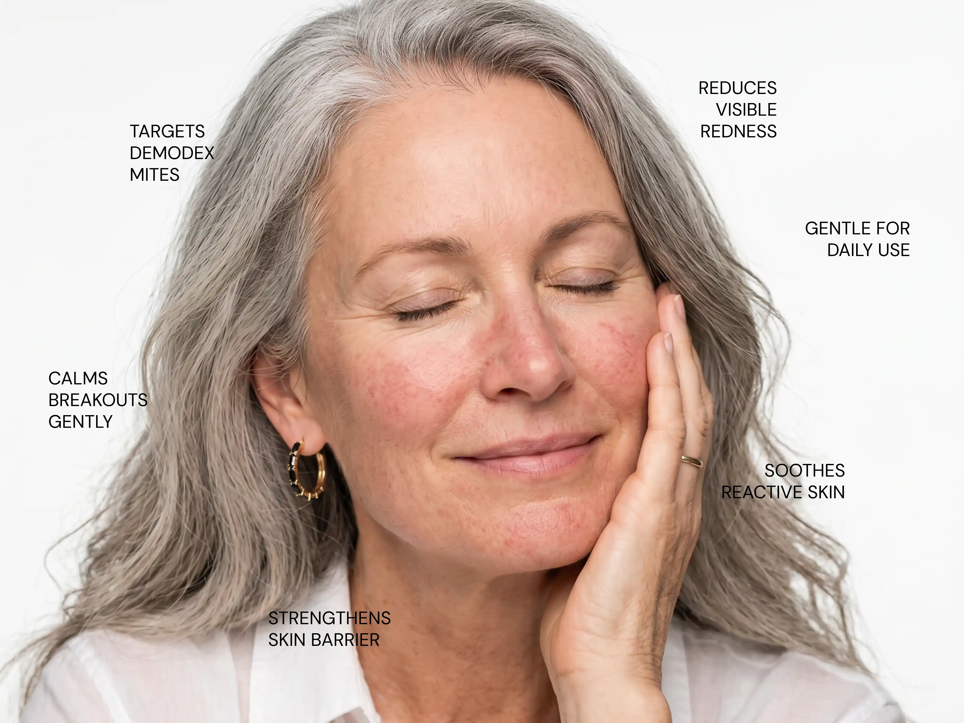 How does Rosacea Formula: Sensitive work?