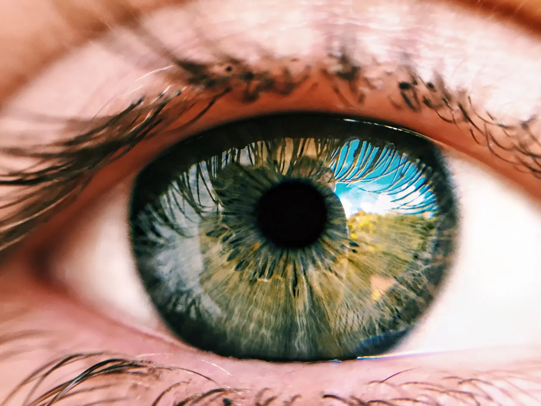 Advancing the Treatment of Myopia in Children