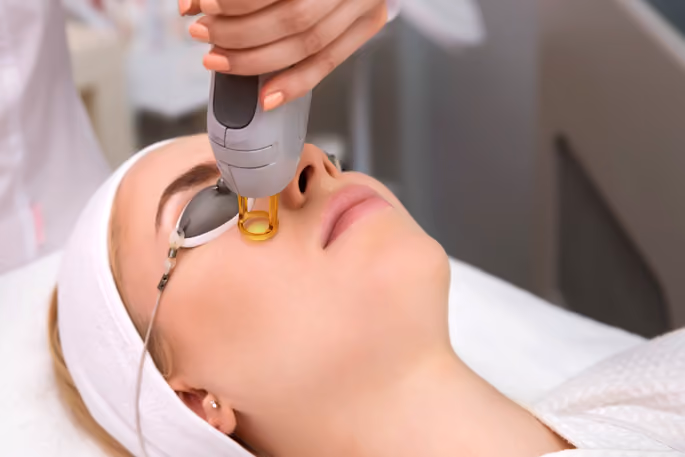 IPL Photofacial treatment at a medspa in Greenwood, Colorado.