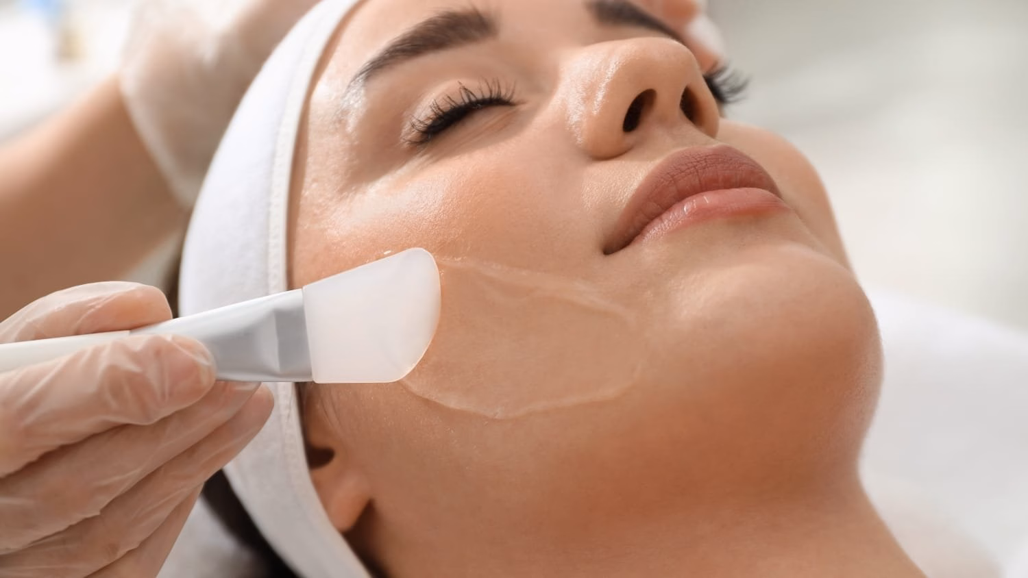 Chemical peel treatment at a medspa in Greenwood, Colorado.