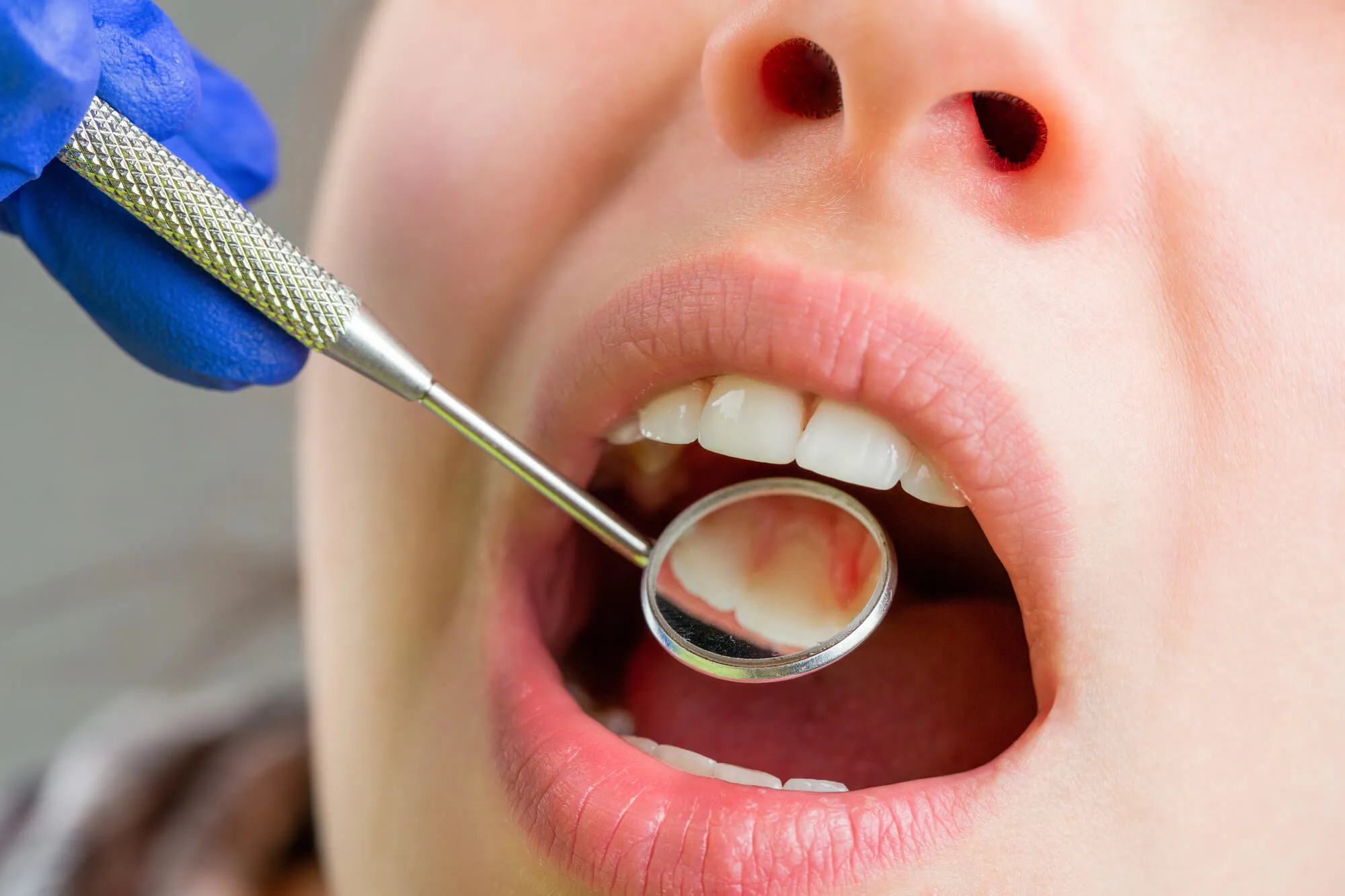 The Pros and Cons of Ceramic Dental Implants 